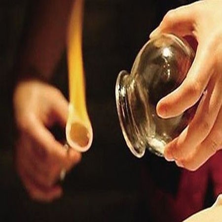 三明专业玻璃拔罐